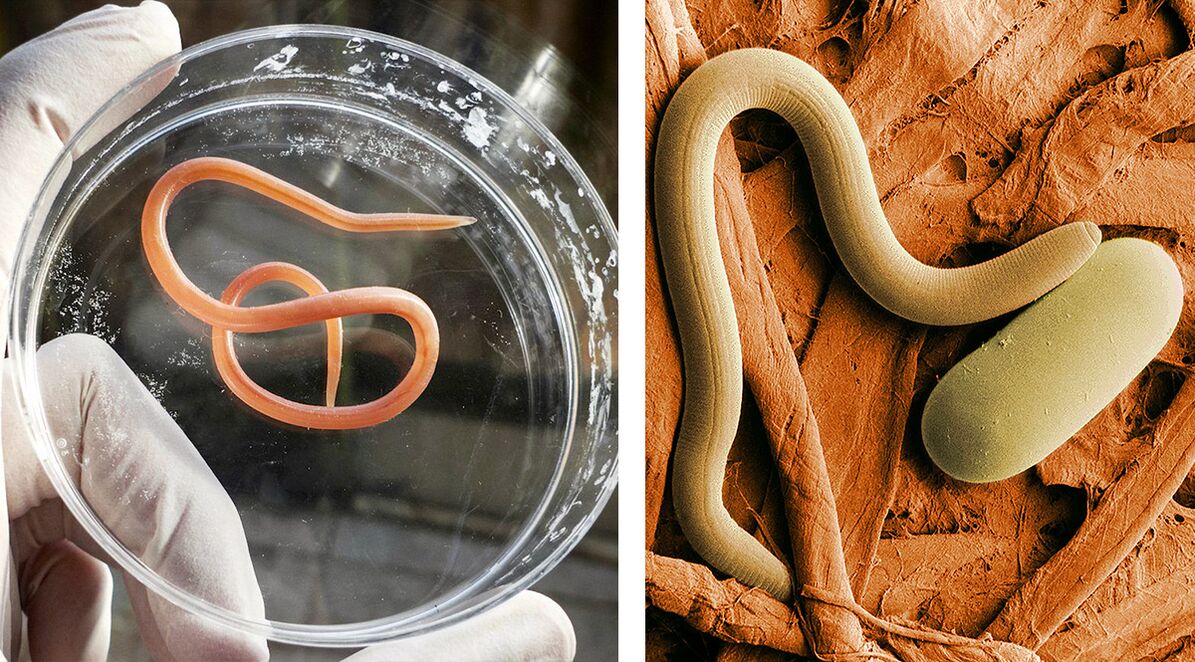 παράσιτα στο ανθρώπινο σώμα